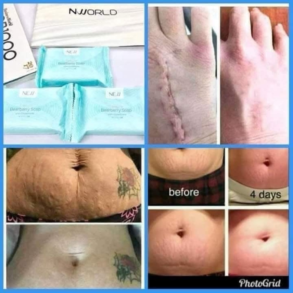 NLIGHTEN Sakura Bearberry Soap 📌Please read Description📌 - Picture 9 of 14